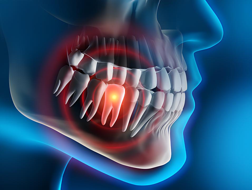 Teeth image - Emergency dentist Borehamwood