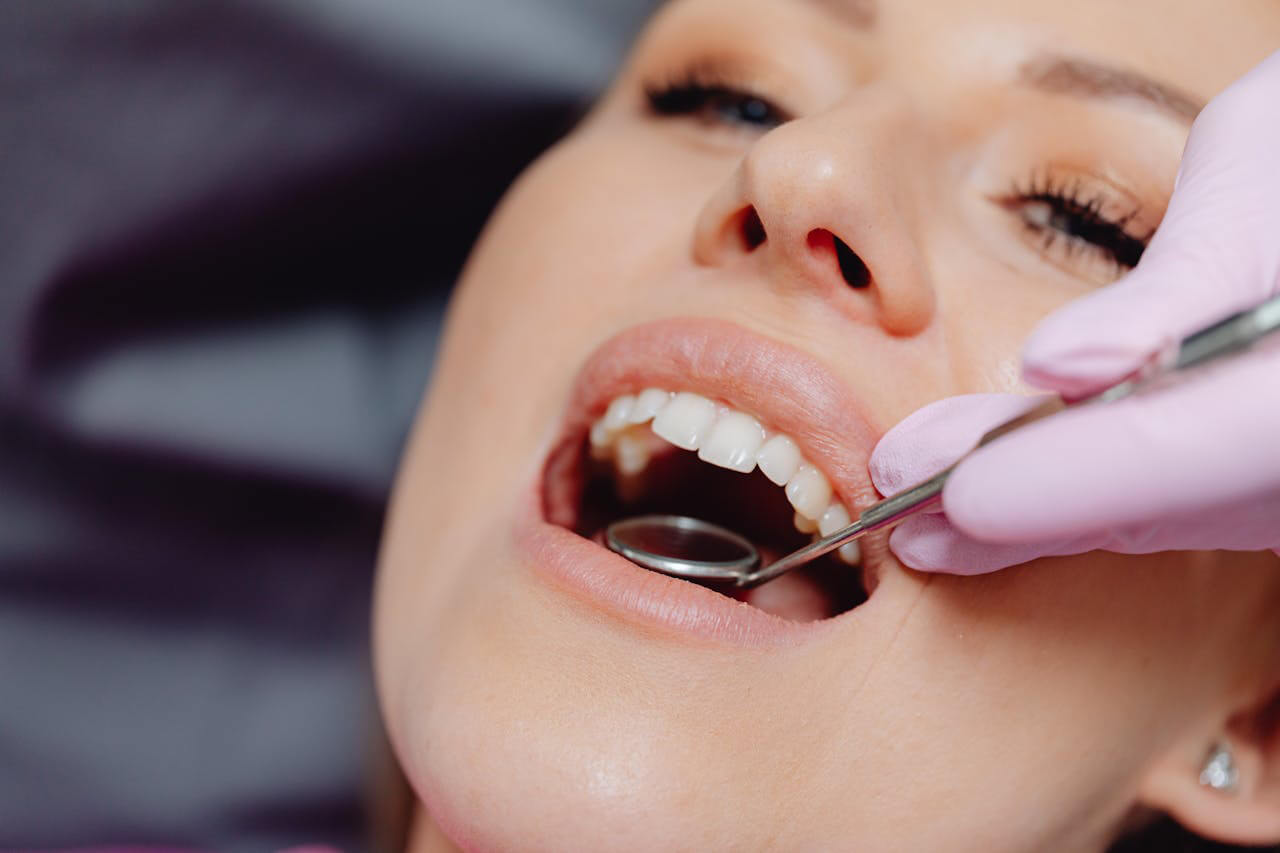 Dental repair treatment for broken tooth